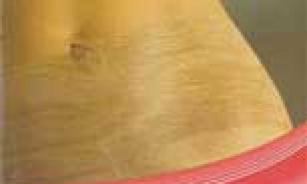 Veneer Edging Concepts